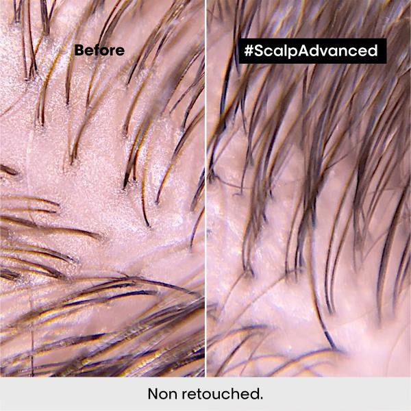 Scalp Advanced - Dermo-Purifier Shampoo 16.9oz