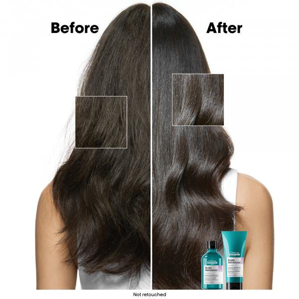 Scalp Advanced - Shampoo 16.9oz - Refill Pouch
